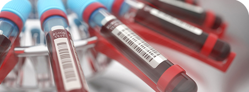 análisis bioquímico