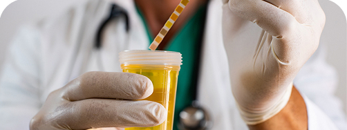 análisis bioquímico