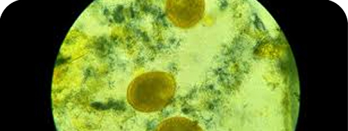 análisis bioquímico